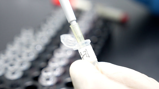 New Study Highlights Resveratrol’s Role in Gut Health for Kidney Disease